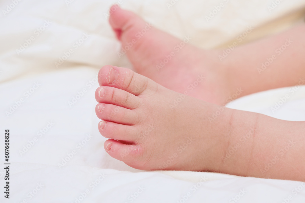 White sheets and newborn feet White sheets and newborn feet