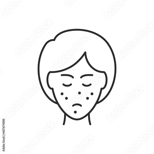 Girl with rash on face icon. Vector illustration isolated on white. Editable stroke.