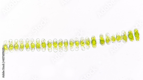 Spondylosium javanicum, a filamentous green algae from desmid group. Collected from Bogor, West Java. Fresh sample. 40x objective. Stacked photo photo