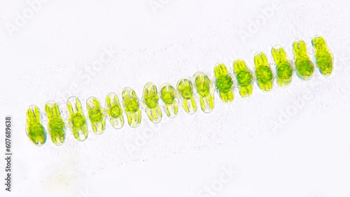 Spondylosium javanicum, a filamentous green algae from desmid group. Collected from Bogor, West Java. Fresh sample. 40x objective. Stacked photo photo