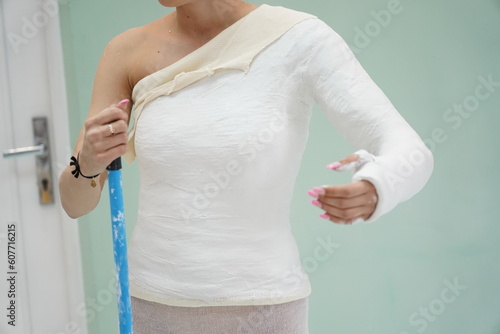 Shoulder Spica Orthopedic Plaster Cast Broken Arm