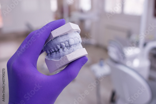 Hand of dentist holding dental gypsum models