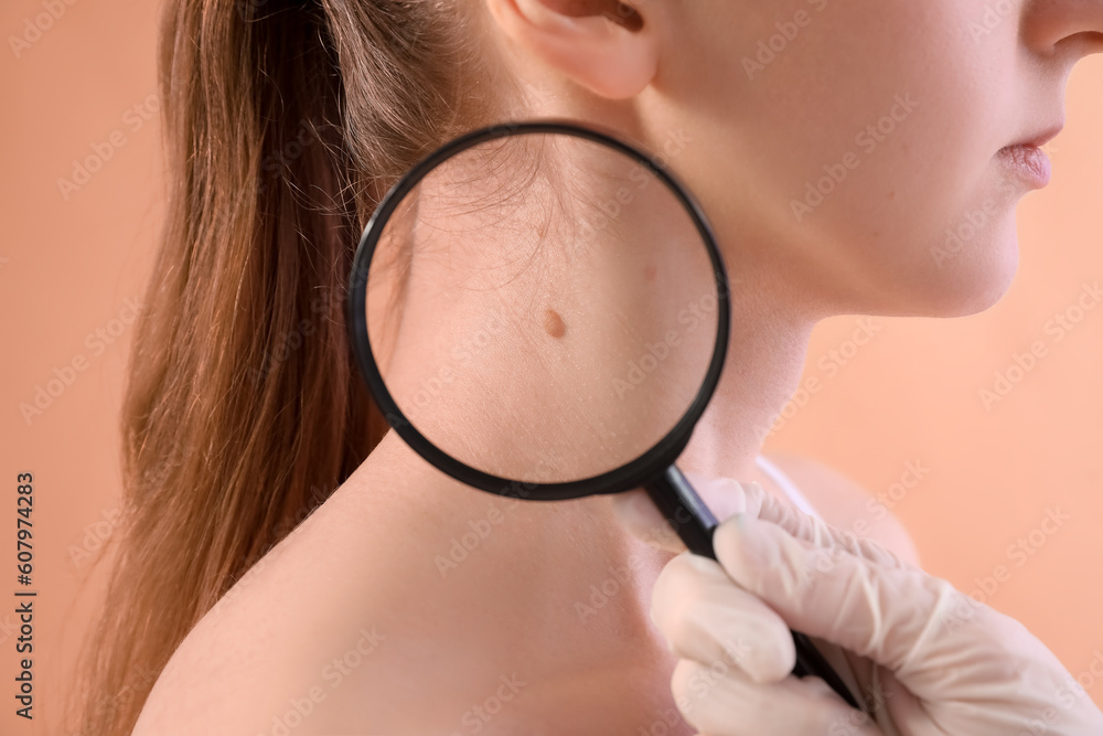 Dermatologist examining young woman's mole with magnifier on beige background, closeup