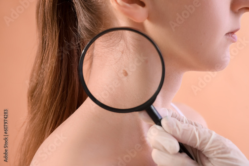 Dermatologist examining young woman's mole with magnifier on beige background, closeup