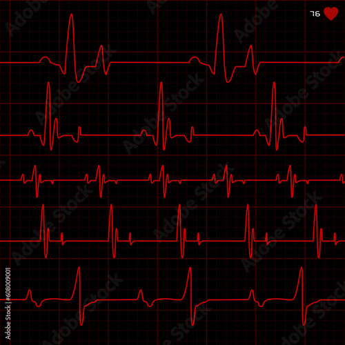 Set of vector cardiograms