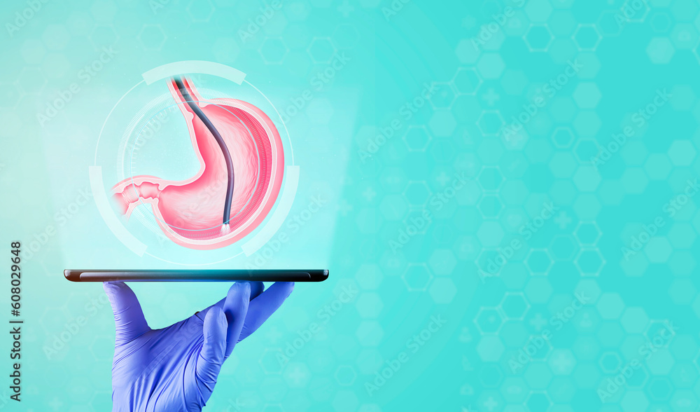 Endoscopic biopsy, esophagogastroduodenoscopy, EGD. The doctor's hand