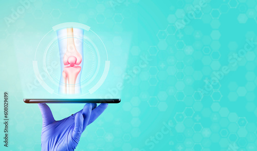 Joint pain, arthritis. Knees with inflammation and pain. Knee and cartilage problems. The doctor's hand holds a tablet and shows a knee. Isolated with light blue background. photo