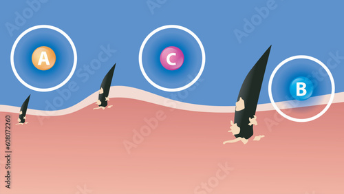 human hair dandruff, clean hair, hair vitamins, vector illustration
