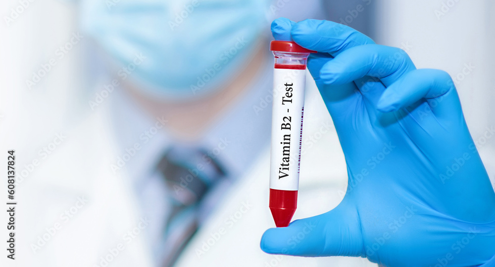 Doctor holding a test blood sample tube with vitamine B2 test. Doctor holding a test blood sample tube with vitamine B2 test.