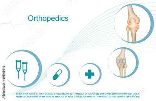 Technology for treatment of knee bone. Abstract traumatology and orthopedics. Medical science in the hospital for body joints.