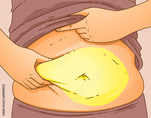 A woman's body with problem areas. Belly fat. Medical infographic. Healthcare illustration. Vector illustration. 