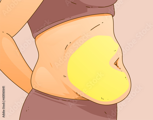 A woman's body with problem areas. Belly fat. Medical infographic. Healthcare illustration. Vector illustration. 