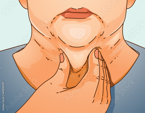 Double chin. The woman with age problems on her face. Plastic surgery. Face correction. Healthcare illustration. Vector illustration. 