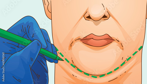 Double chin. The woman with age problems on her face. Plastic surgery. Face correction. Healthcare illustration. Vector illustration. 