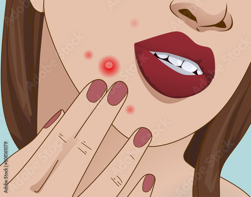 The young girl with skin problems.  Acne problems, damaged skin. Healthcare illustration. Vector illustration.