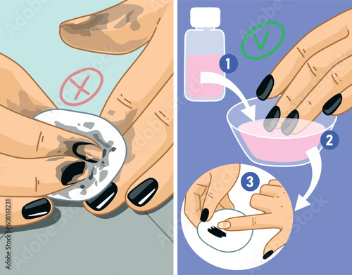 DIY illustration. Removing the nail polish. Tips and tricks. Manicure. Lifehack. Vector illustration. 