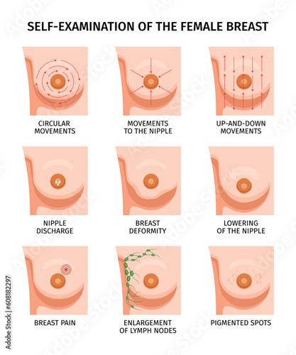 Breast Self Examination Set