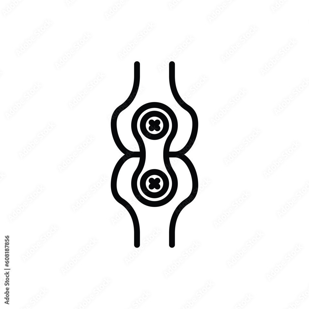 Arthrodesis joint surgery thin line icon. Arthritis. Vector illustration. Arthrodesis joint surgery thin line icon. Arthritis. Vector illustration.
