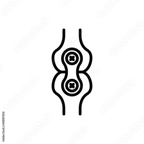 Arthrodesis joint surgery thin line icon. Arthritis. Vector illustration.