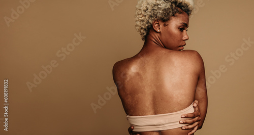 Confident Gen Z woman embracing her unique skin tone photo