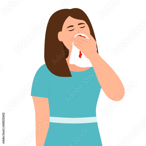  Woman Holding Tissue or Handkerchief and Wiping Blood Off Her Nose. Nose Bleeding Symptom. Vector illustration