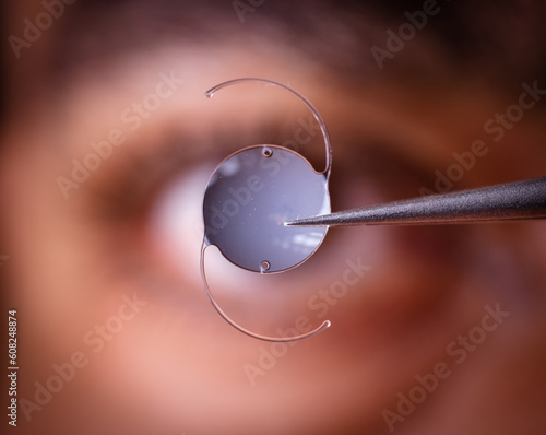 Foto photo of intra ocular lens IOL for treating cataract infront of surgeon eye