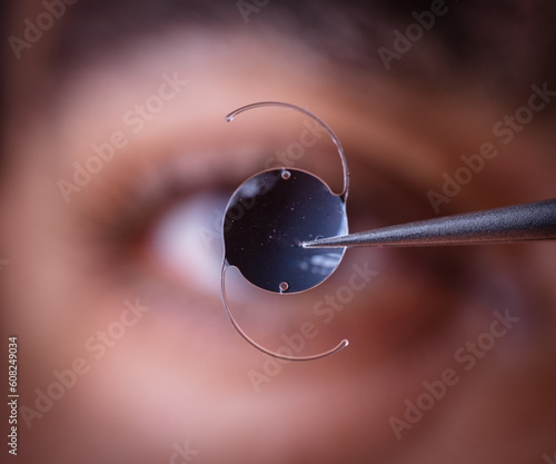 photo of intra ocular lens IOL for treating cataract infront of surgeon eye
