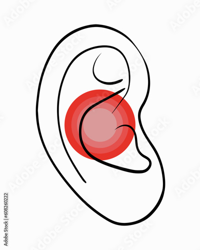 Vector isolated illustration of ear diseases. Pain in the ear. Cerumen. Otitis. Otolaryngologist.
