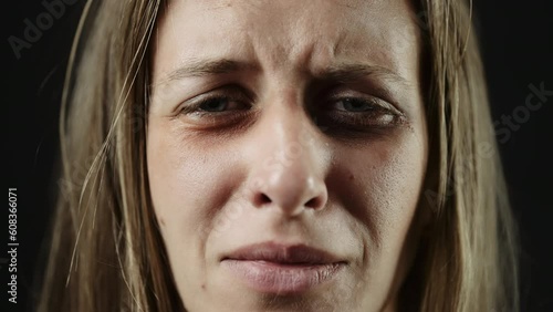 A sad beaten up woman with tear in eye and bruises is crying or shouting. Female depression because of domestic violence. Need help and support. Concept violence or cruelty and hopelessness or despair