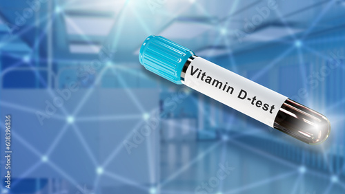 Vitamin D test. Test tube w...