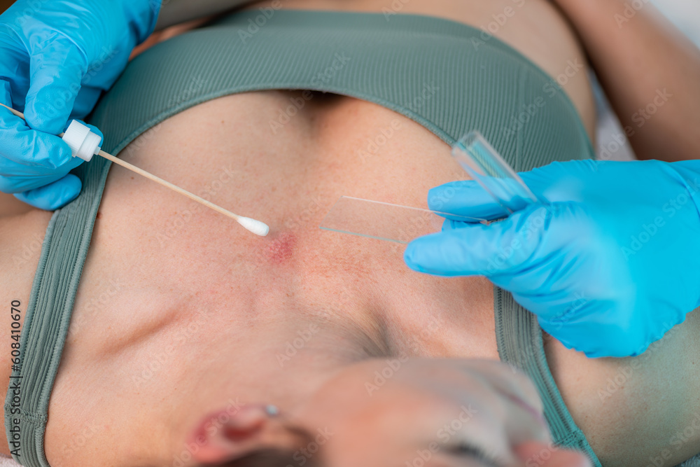 Examination of Skin Lesions. Dermatologist Uncovering Insights for Diagnosis and Care. Examination of Skin Lesions. Dermatologist Uncovering Insights for Diagnosis and Care.