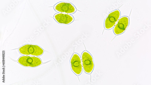 Fotografie Staurodesmus convergens, a single cell freshwater green microalgae that produce exopolysaccharide