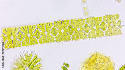 Filament-forming phytoplankton, Micrasterias foliacea. Live cell. Selective focus photo