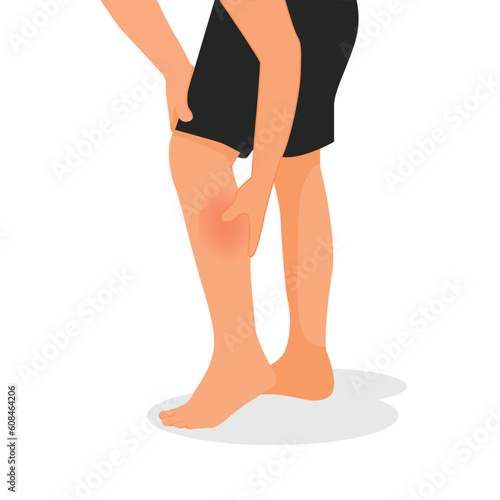 Man hands holding his painful calf suffering leg injury after running exercising
