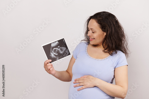 Portrait of a happy pregnant woman touching belly, holding ultrasonography of her baby, isolated white background. Excited amazed gravid female expecting baby. Ultrasound diagnostics during pregnancy