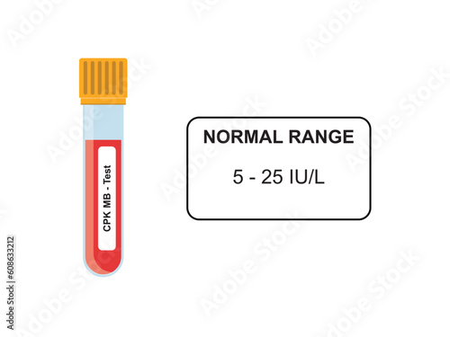 CPK Blood Test Concept Design. Vector Illustration.