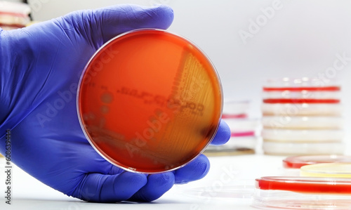 Escherichia coli (E. coli) bacteria growing in a Petri dish with Agar-blood culture medium, in the Microbiology laboratory