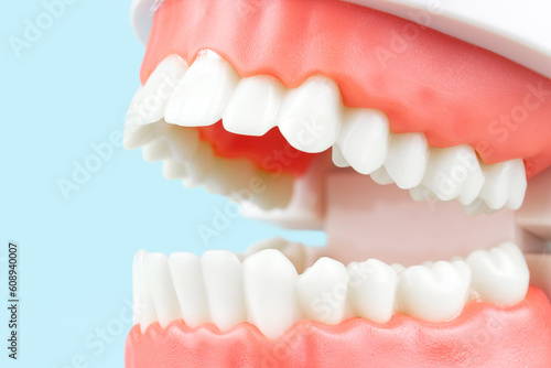 Model of human teeth  Full Denture  Dental plate. Teeth orthodontic dental model or human jaw. Selective focus on teeth.