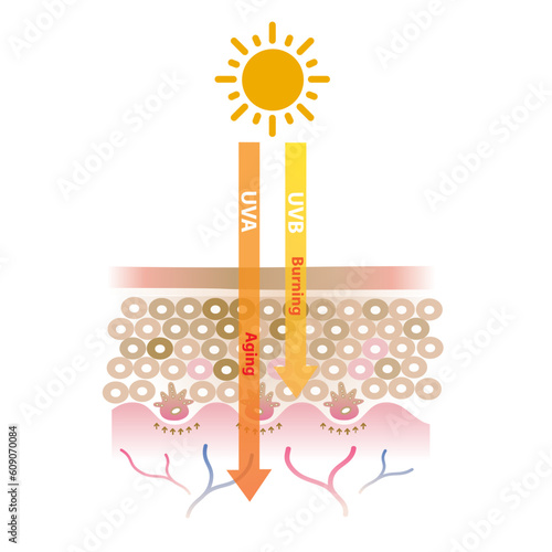 Infographic of UVA and UVB radiation penetrate into the skin layer vector on white background. UVA rays cause aging skin, UVB rays cause burning skin. Skin care and beauty concept illustration.