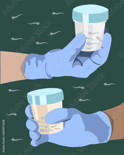 Sperm donation. Sperm analysis. Spermogram. Vector isolated illustration of jar with sperm held by hand. Sperm defects.