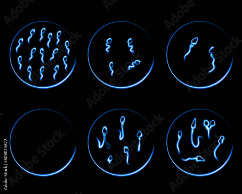 Vector isolated illustration of sperm pathologies. Spermogram. Sperm defects. Defects of the sperm head.  Sperm motility.