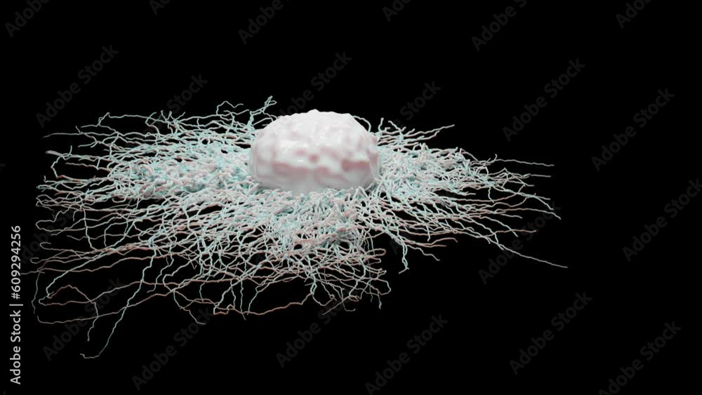 Cancer cell growth uncontrollably over tissue, Tumor infection cells ...