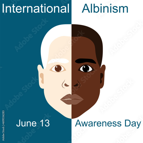 International Albinism Awareness Day. Black albino boy. Genetic rare disorder.