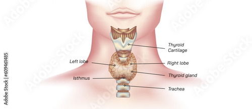 hypothyroidism vs hyperthyroidism. healthy and unhealthy thyroid test. Thyroid tumour and inflammation treatment. Parathyroid glands. neck pain and sore. Throat cancer and esophagus. Goitre problem. 