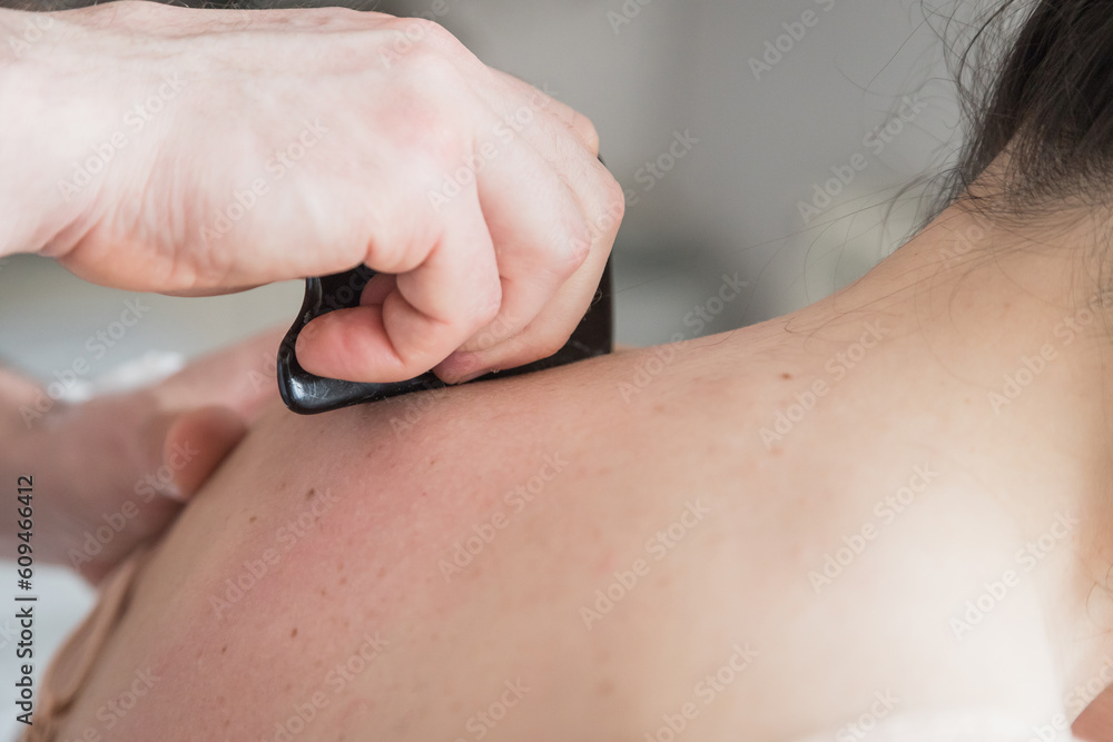 Fototapeta premium Young Caucasian Woman Getting Body Treatment. Therapist doing skin scrape technique. Chinese technique, gua sha, for pain relief and treatment and activating blood circulation. Stimulus therapy.