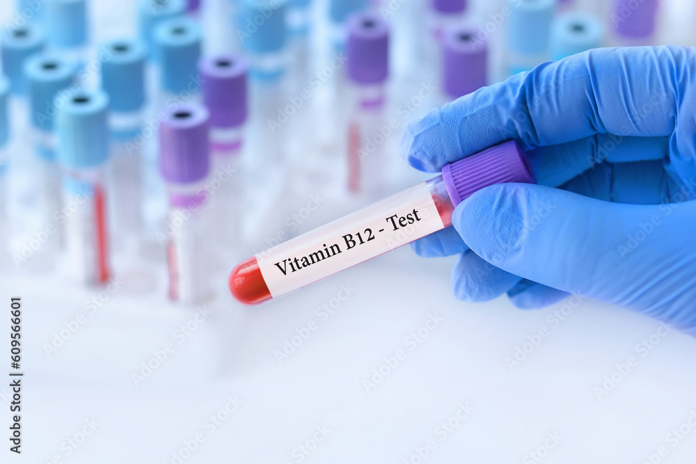 Doctor holding a test blood sample tube with Vitamin B12 test on the