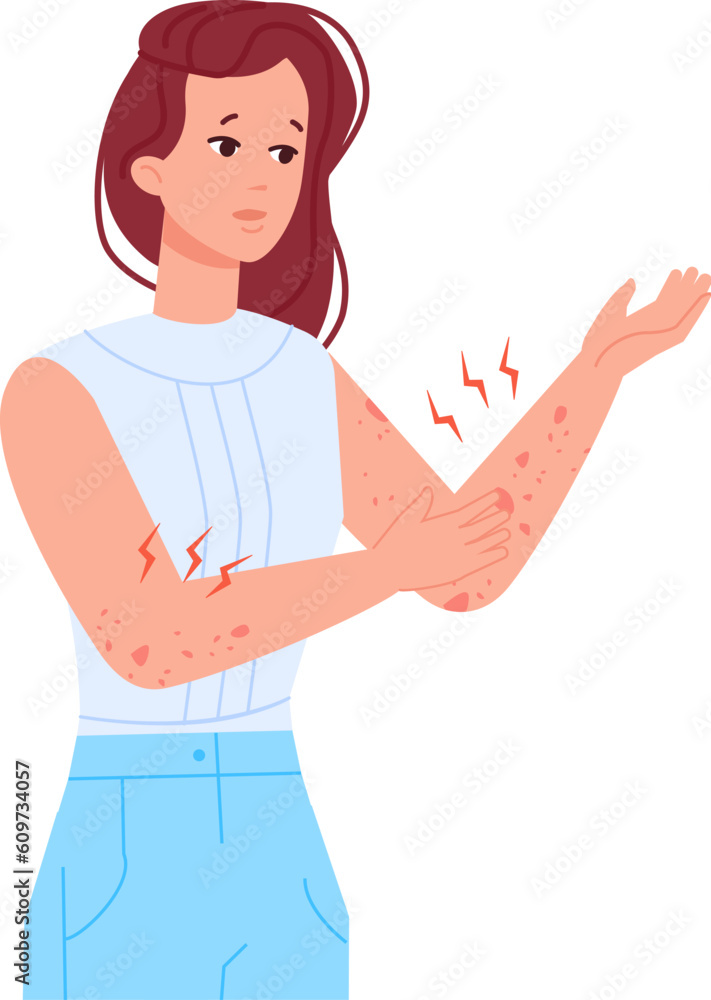 Woman scratching skin. Girl with itching elbow hand or rash on body, allergic infection itchy eczema urticaria pele atopic dermatitis symptoms, Woman scratching skin. Girl with itching elbow hand or rash on body, allergic infection itchy eczema urticaria pele atopic dermatitis symptoms,