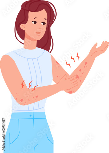 Woman scratching skin. Girl with itching elbow hand or rash on body, allergic infection itchy eczema urticaria pele atopic dermatitis symptoms,