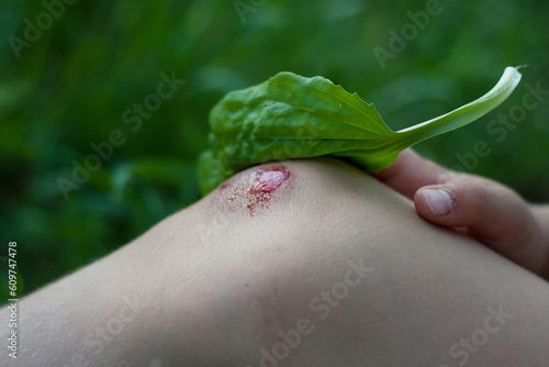 Closeup of fresh bleeding wound on child knee due to fall. child applies plantain leaf to wound. Children injuries in summer outdoors. Phytotherapy, folk medicine. photo