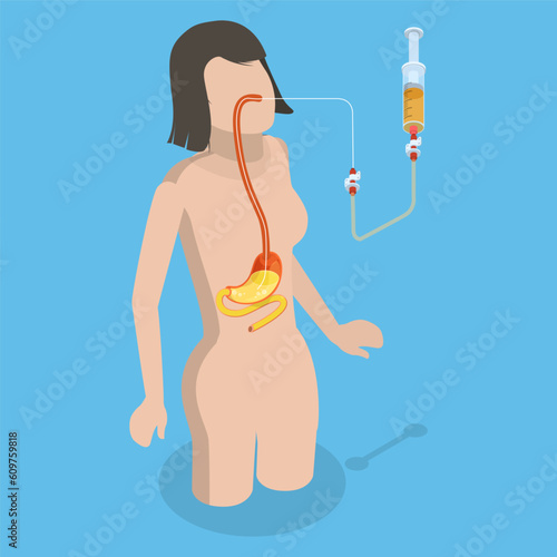 3D Isometric Flat Vector Conceptual Illustration of PEG, Nasogastric Tube Passed Through the Nose to Stomach